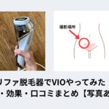 リファ脱毛器でVIOやってみた！痛み・効果・口コミまとめ【写真あり】