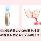 Ulike脱毛器のVIO効果を検証！Air10の写真レポと4モデルの口コミ比較