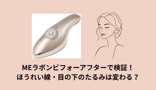 MEラボンビフォーアフターで検証！ほうれい線・目の下のたるみは変わる？