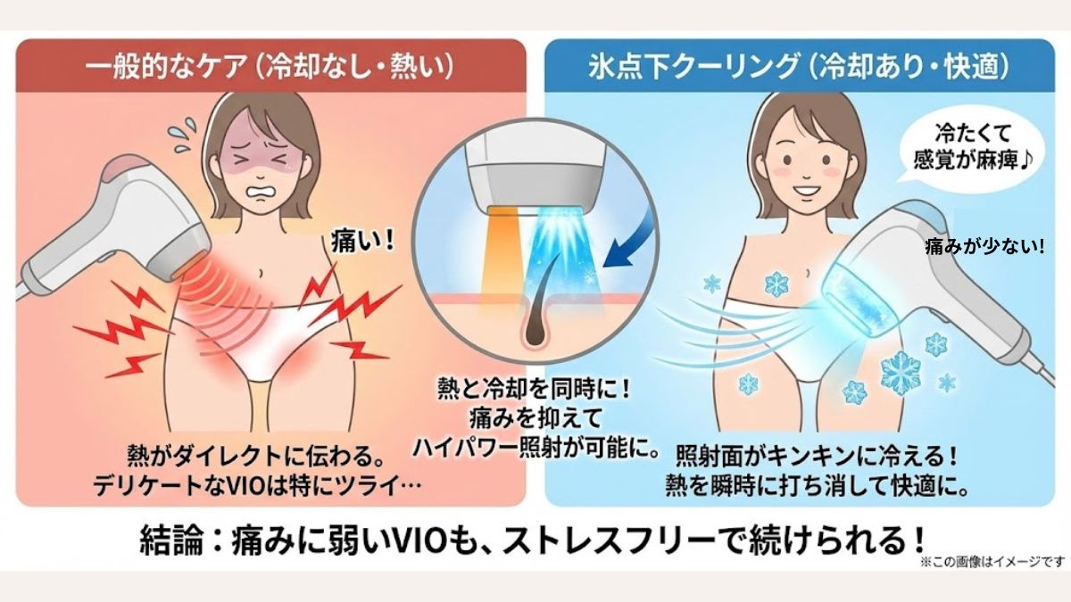 【解決策】痛みが少ない＆最短ケアなら「Ulike Air10」！毎日の手間から解放されよう