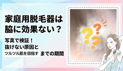 家庭用脱毛器は脇に効果ない？写真で検証！抜けない原因とツルツル肌を目指すまでの期間