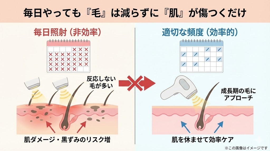 結論：VIOの毎日は逆効果！効率よくツルツルを目指すなら「週1〜3回」×「ハイパワー」が正解