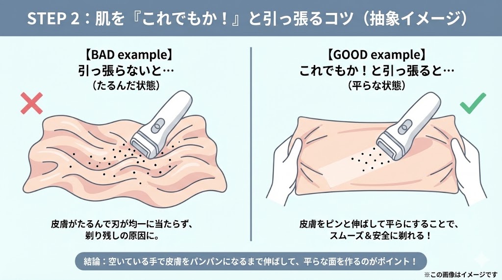 不快感を最小限に抑える！VIOフェリエの「チクチクしない」正しい使い方