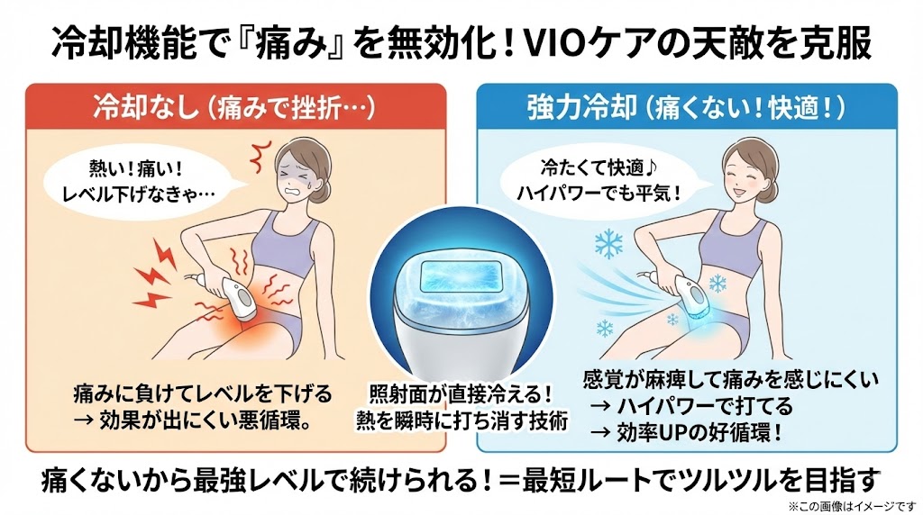 毎日照射しなくても大丈夫！冷却機能付きハイパワー脱毛器を選ぶべき3つの理由