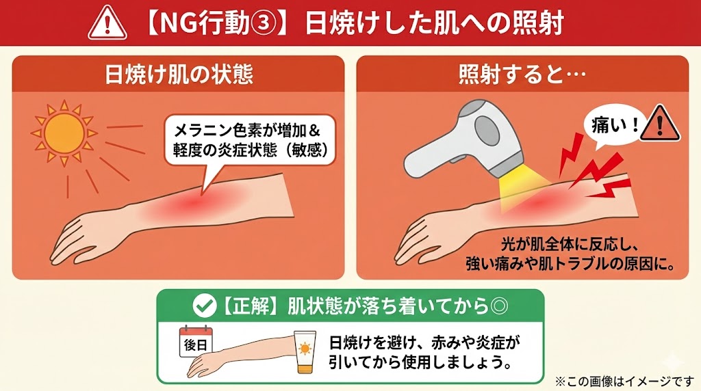 まだある！家庭用脱毛器でやりがちな「保湿」以外のNG行動