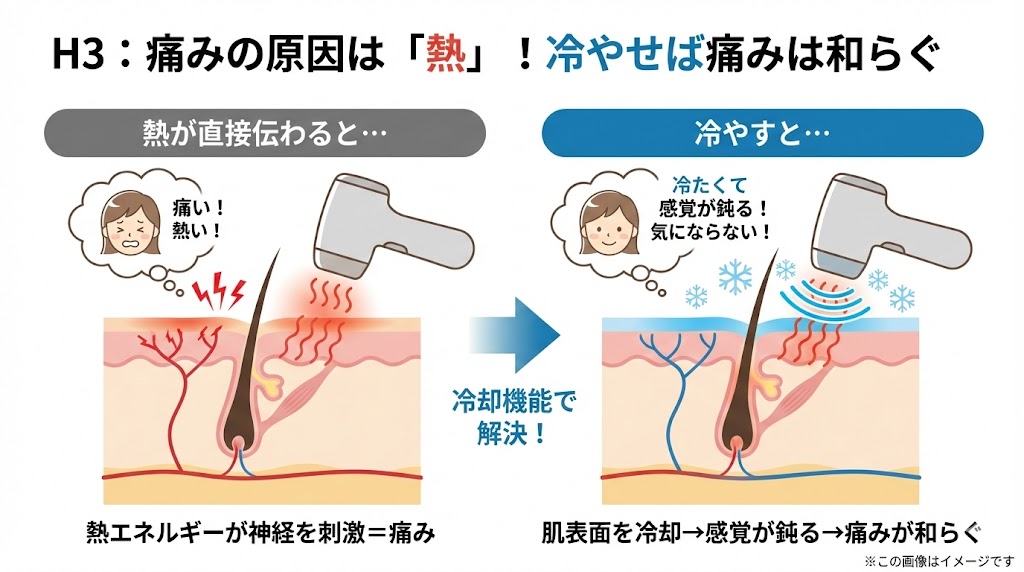 結論:「痛みが少ない=効果がない」は誤解!「冷却×ハイパワー」なら両立できる