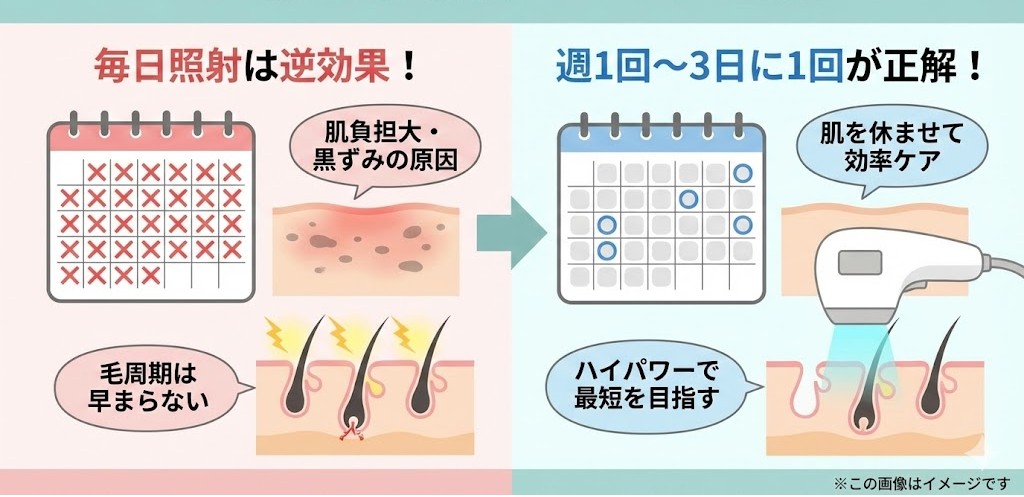 家庭用脱毛器vio毎日は逆効果！3日に一回でいい？効率よくツルツル肌を目指す頻度とコツ