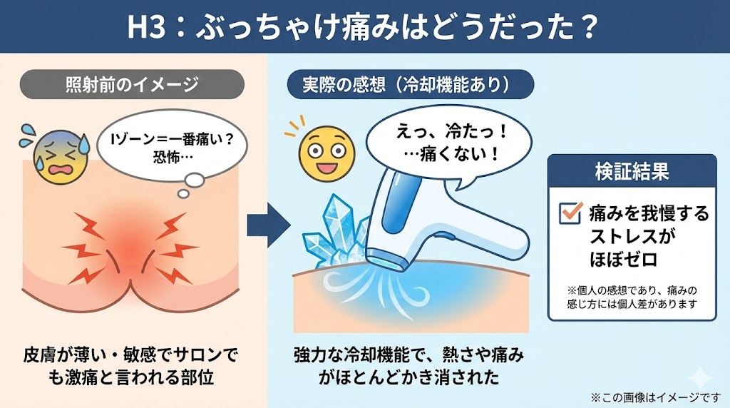 【検証写真あり】効果が出るまで何回?Iゾーンで「痛み」と「変化」をガチ検証